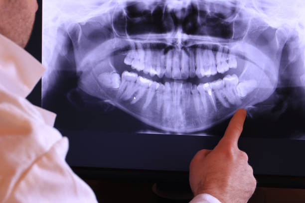 Best Holiday Emergency Dentist in Mercer, PA
