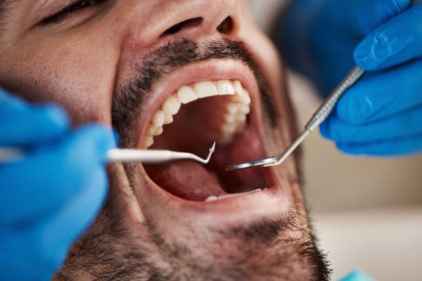 Best Weekend Emergency Dentist in Mercer, PA